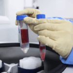 Platelet Rich Plasma Injections